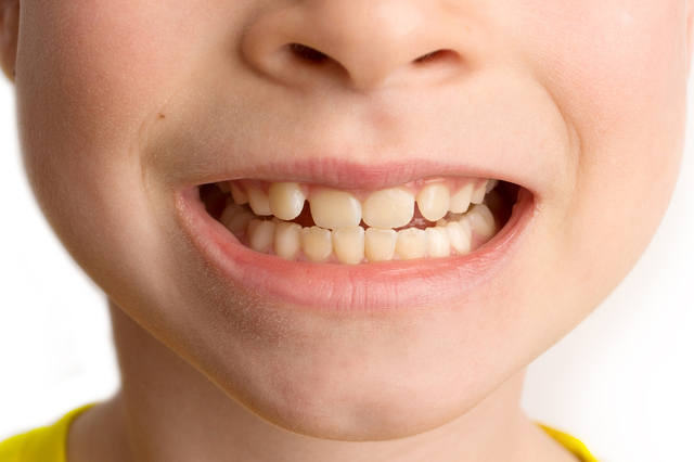 綺麗な子供の歯の写真